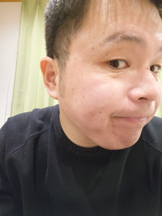 炭酸パックビフォー