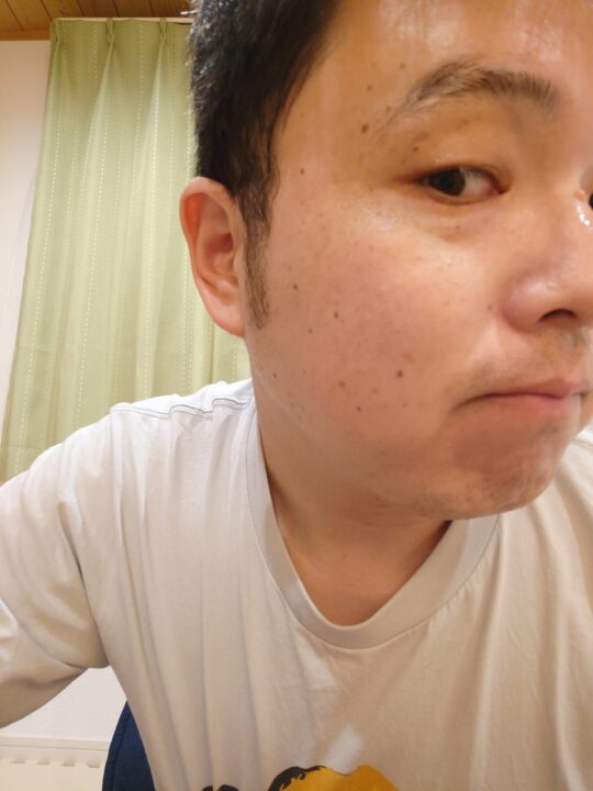 炭酸パックチャレンジ